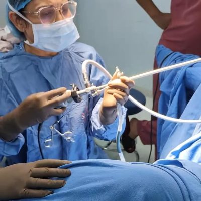 Hysteroscopy Surgery